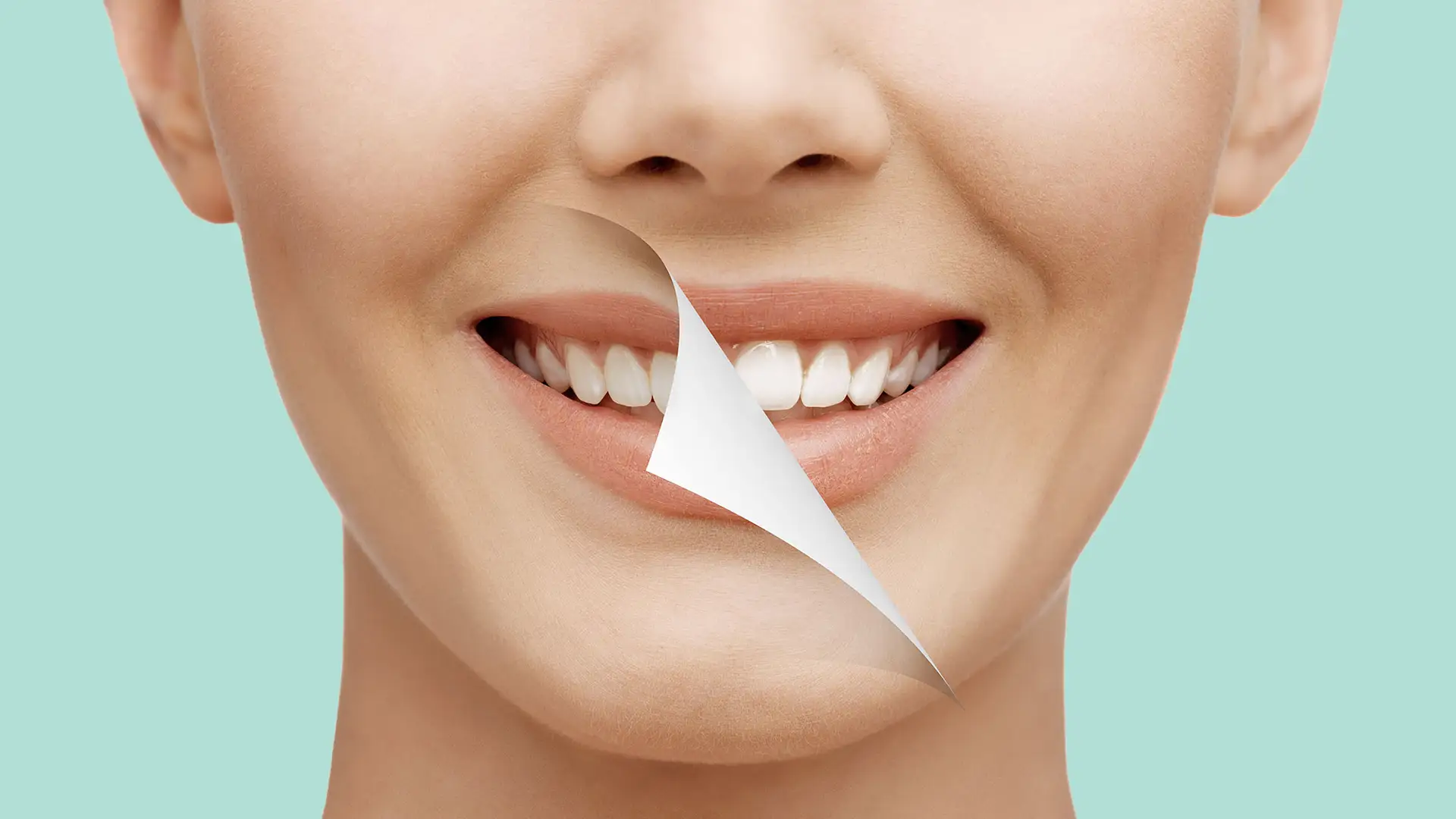 Sbiancamento dentale - consigli per un sorriso splendente - Studio Dentistico Donatelli, Tricase - Dentisti in Salento, Lecce