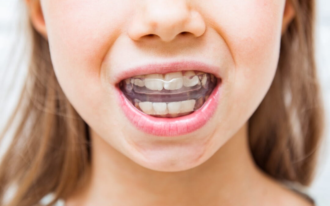 Deglutizione atipica: cos’è e come correggerla nei bambini