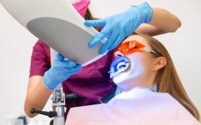 Quali sono i rischi dello sbiancamento dentale?
